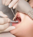 טיפול שיניים בהרדמה מלאה - תמונת אווירה
